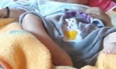 Empati Rekan Media SPRI Kunjungi Balita Pengidap  Hidrosefalus dan Sindiom