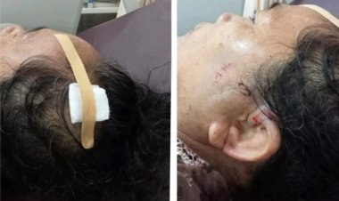 Oknum Bidan Aniaya Nenek, Kabid Humas Polda Lampung: Kasusnya Sudah Naik Penyidikan