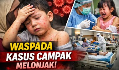 Kasus Campak Kembali Meningkat, Masyarakat Diminta Waspada dan Lengkapi Imunisasi